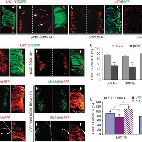 Downregulation Of Sox Expression Is Required For The Progression Of