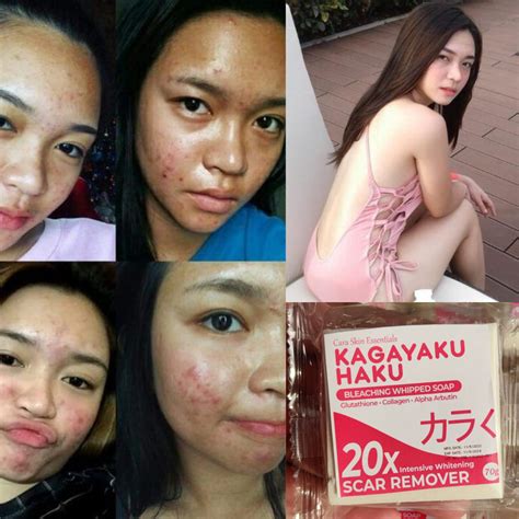 Instant Whitening With Scar Remover 100 Legit Na Sabon Pampaputi