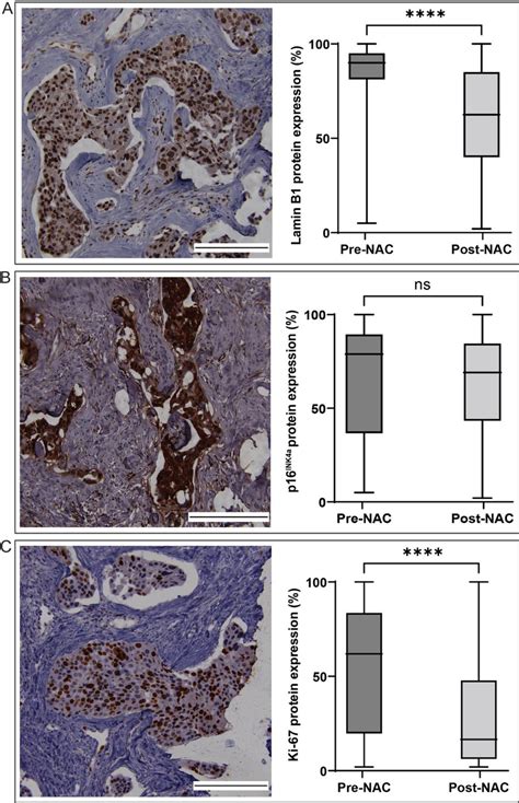 Immunohistochemistry IHC Analysis Of The Overall Lamin B1 P16INK4a