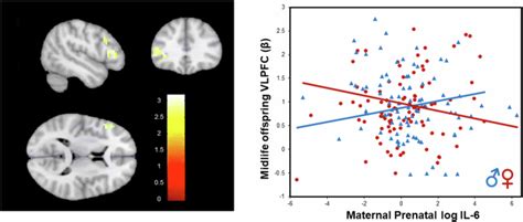 Prenatal Immune Origins Of Brain Aging Differ By Sex Molecular Psychiatry