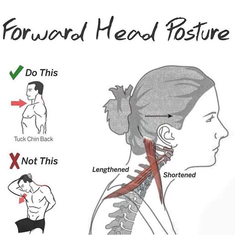 Pin on Neck Exercises