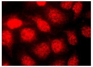 Oxog Dna Lesion Scbt Santa Cruz Biotechnology