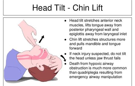 Jaw Thrust Maneuver Animation View An Animation, 47% OFF