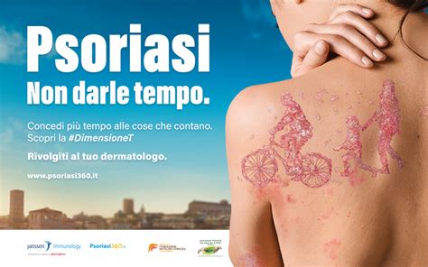 Giornata Mondiale Della Psoriasi 2019 La Nuova Dimensione Nell