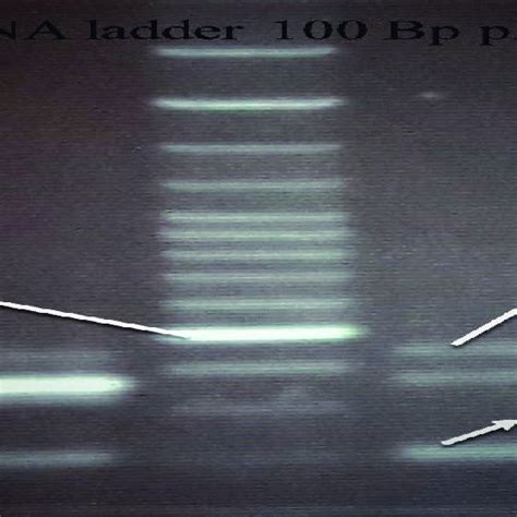 The Detection Of Stx1 Stx2 EaeA And HlyA Genes By Multiplex PCR Stx1