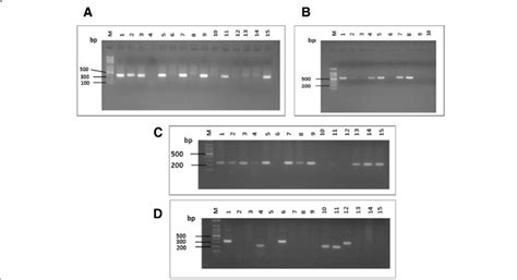 Agarose Gel Electrophoresis Of The PCR Based Genotyping Amplified