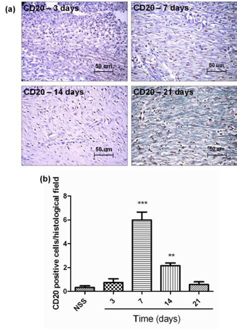 A Cd3 Positive Endothelial Cells Showing Cytoplasmic Download