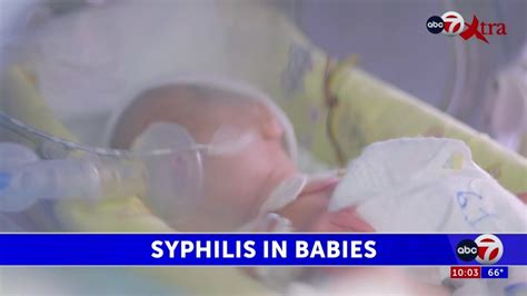 Newborn Syphilis Cases On The Rise In U S And El Paso Youtube