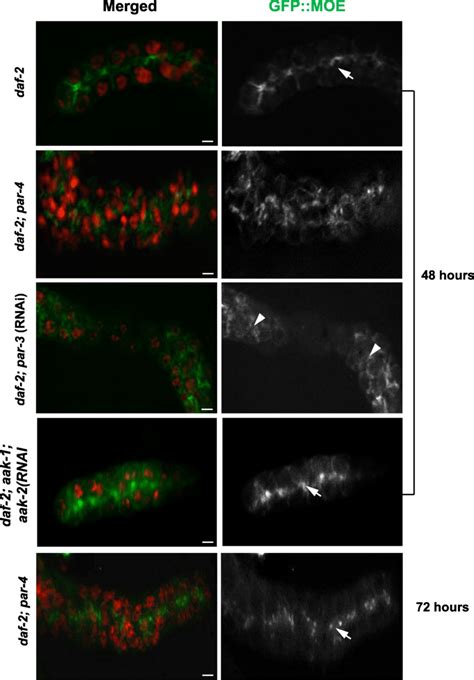 The Organization Of The Actin Cytoskeleton Is Initially Perturbed But