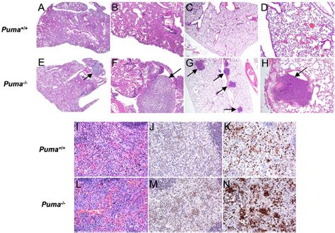 Histopathology Of Bacterial Infected Organs Ah Representative H And E