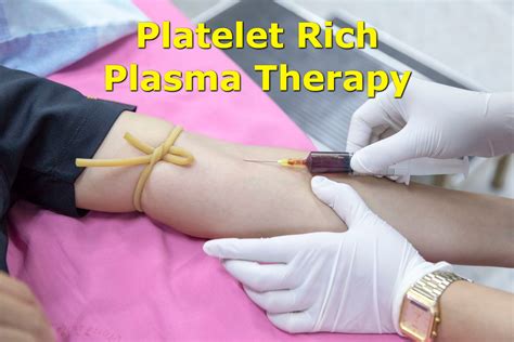 A Primer On Prp Therapy A Guide To Platelet Rich Plasma And Its Uses