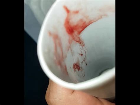 Colombiana amateur cérvix jugar parte 9 XVIDEOS