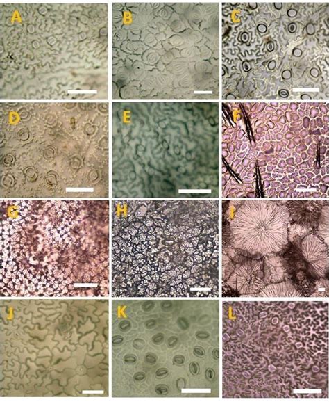 Photographs Of Leaf Epidermal Cells On The Abaxial Surface By Light Download Scientific Diagram