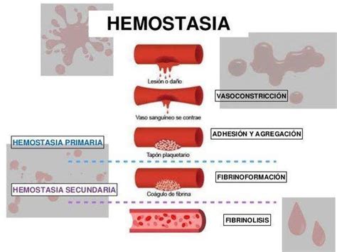 A Hemostasia Dividida Em Duas Etapas Fases Que Ocorrem Sucessivamente