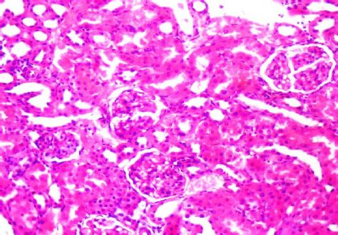 Liver Histology Of The Kidney Of Rats Treated With Tween