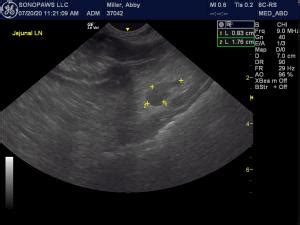 Reactive lymph node? - Members