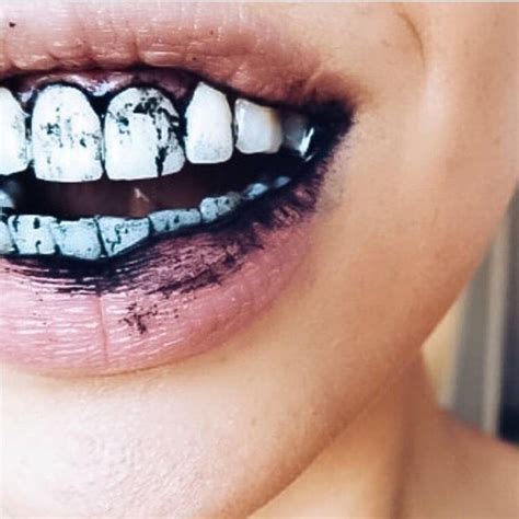 Can Charcoal Actually Whiten Your Teeth Magic Smile Turkey