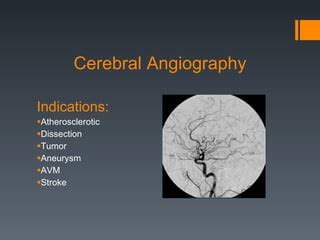 Contrast Agents in Angiography | PPT