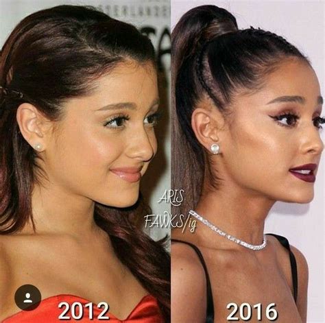 Ariana Grande Before And After Surgery Plastic Surgery Celebrity