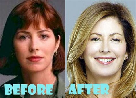 Dana Delany Plastic Surgery Before and After Pictures - Lovely Surgery