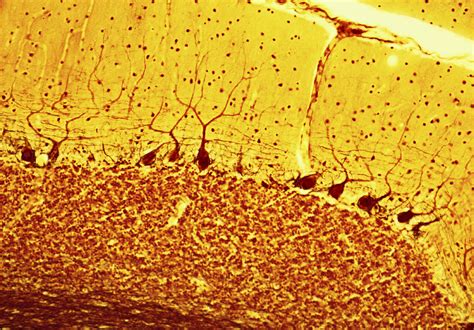 Purkinje Nerve Cells Light Micrograph Photograph By Steve Gschmeissner