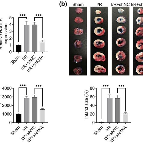 Knockdown Of HAGLR Alleviated Myocardial I R Injury A The Expression