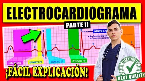 Electrocardiograma Interpretación FÁcil ExplicaciÓn Youtube