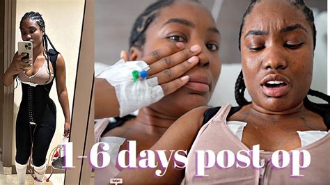 Vlog 1 6 Days Post Op 😰 Liposuction Breast Lift Yall Im In Pain