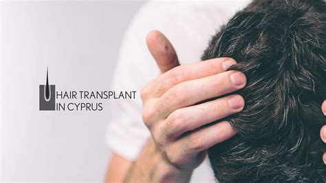 Hair Transplant In Cyprus Cyprus Hair Transplant Procedure