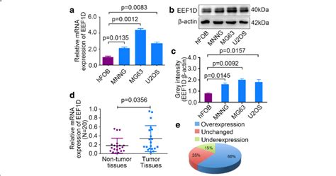 Eef D Is Upregulated In Osteosarcoma Tissues And Cell Lines A B C