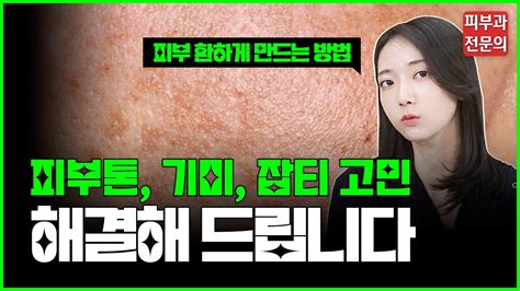 피부 환해지는 치료법 기미 잡티 피부톤 색소침착 피부과 전문의 Youtube