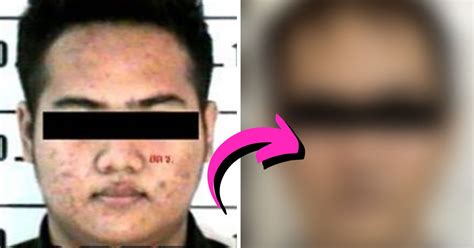 Thai Drug Dealer Undergoes Surgery To Disguise As A Korean Man Gets