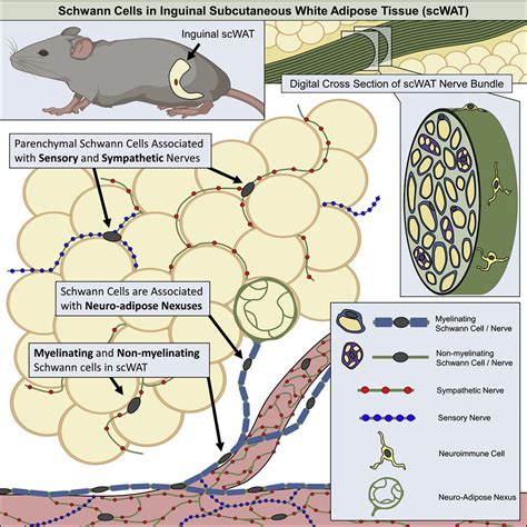 Schwann Cells Contribute To Demyelinating Diabetic Neuropathy And Nerve