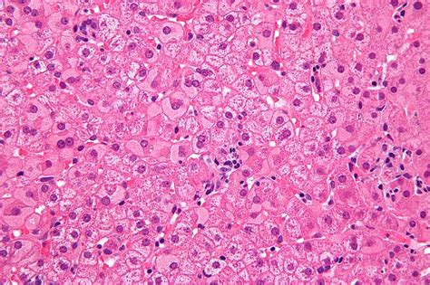 Difference Between Kupffer Cells And Hepatocytes L Kupffer Cells Vs