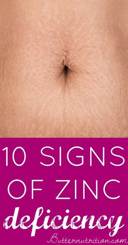 10 Signs Of Zinc Deficiency Artofit