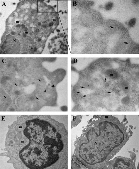 Immuno Electron Microscopy And Ultrastructural Analysis Of PBMC From