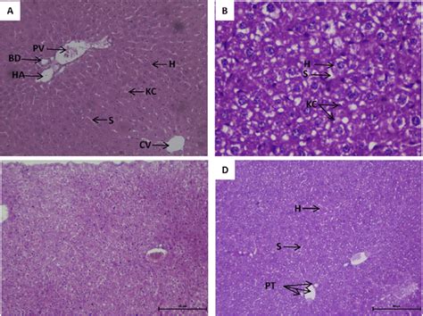 T S Of Liver Of Balb C Mice Stained With Haematoxylin And Eosin Stain