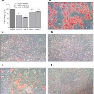 Assessment Of Lipid Accumulation Using Oil Red O Assay A Relative