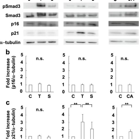 Expression Of P16 And P21 Induced By The Activation Of The Tgf β1 Smad3