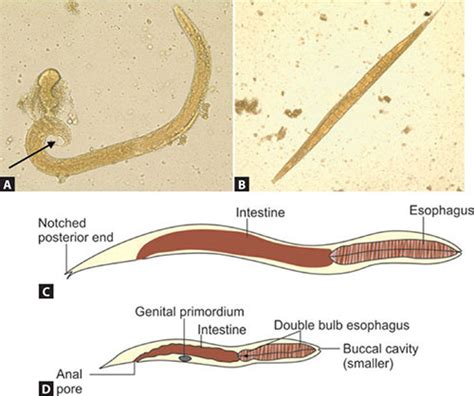 Strongyloides Stercoralis Male Vs Female