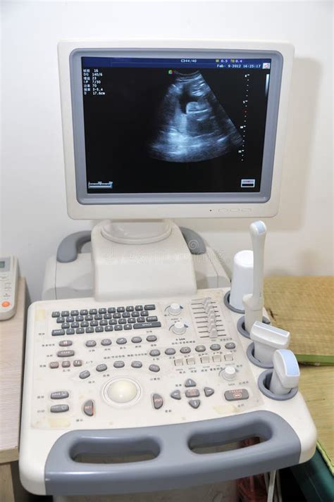 Color Doppler ultrasound stock photo. Image of focus - 23336734