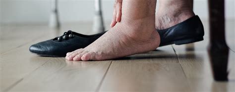 4 Causes Of Swollen Or Inflamed Feet Thomas Podiatry And Associates