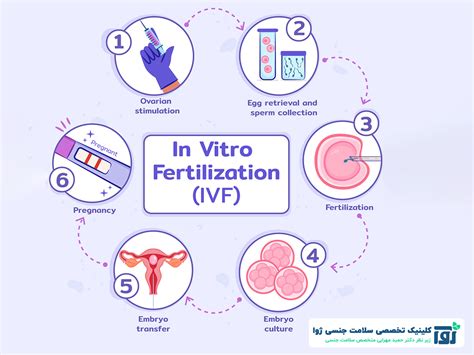 Ivf