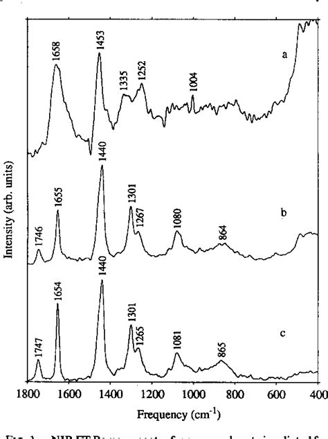 Figure 1 From In Situ Optical Histochemistry Of Human Artery Using Near