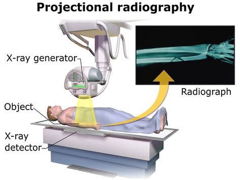 Working Principle Of X Ray Machine Studiousguy