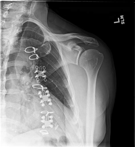 Orthodx Left Shoulder Pain And Stiffness Clinical Advisor