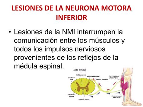 Trastornos Del Tono Muscular Ppt