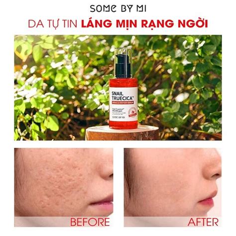 SOME BY MI – THẾ GIỚI SKINFOOD