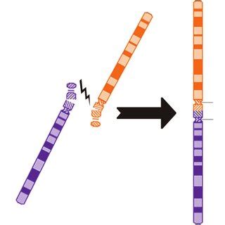 Pdf Robertsonian Translocations