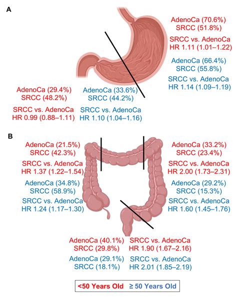 Cancers Free Full Text Effects Of Tumor Localization Age And